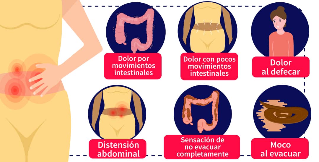 esquema de los principales síntomas de colitis