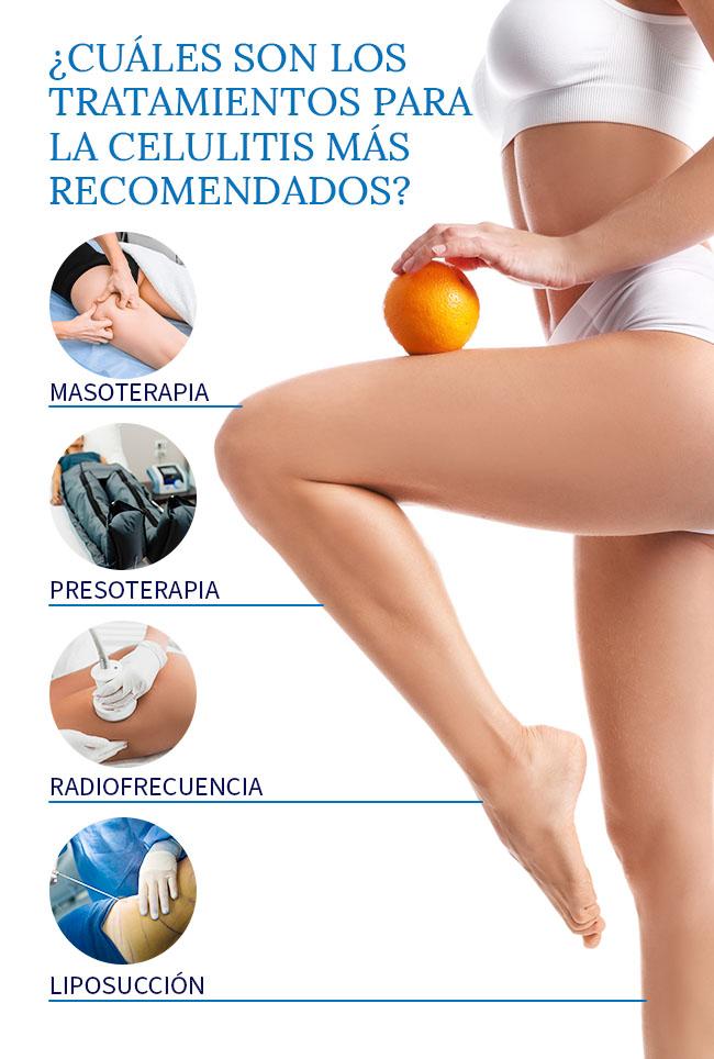 cuales-son-los-tratamientos-para-evitar-la-celulitis-mas-recomendados