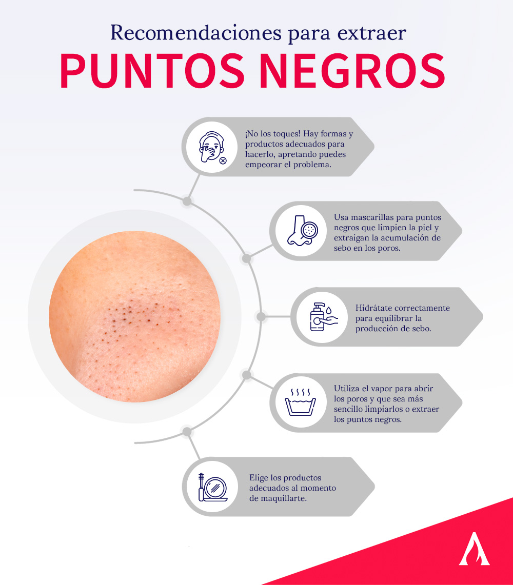 recomendaciones-para-extraer-puntos-negros